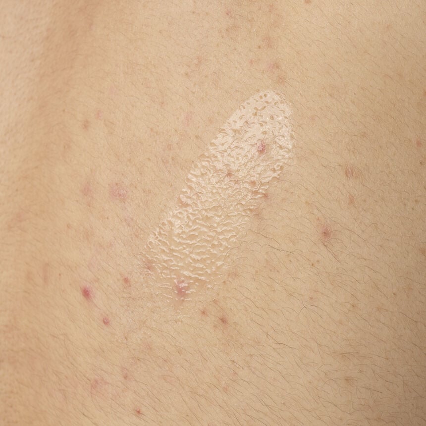 Salicylic Acid 0.5% Body Serum - Image 4