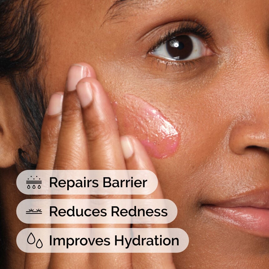 Soothing & Barrier Support Serum Set - Image 5