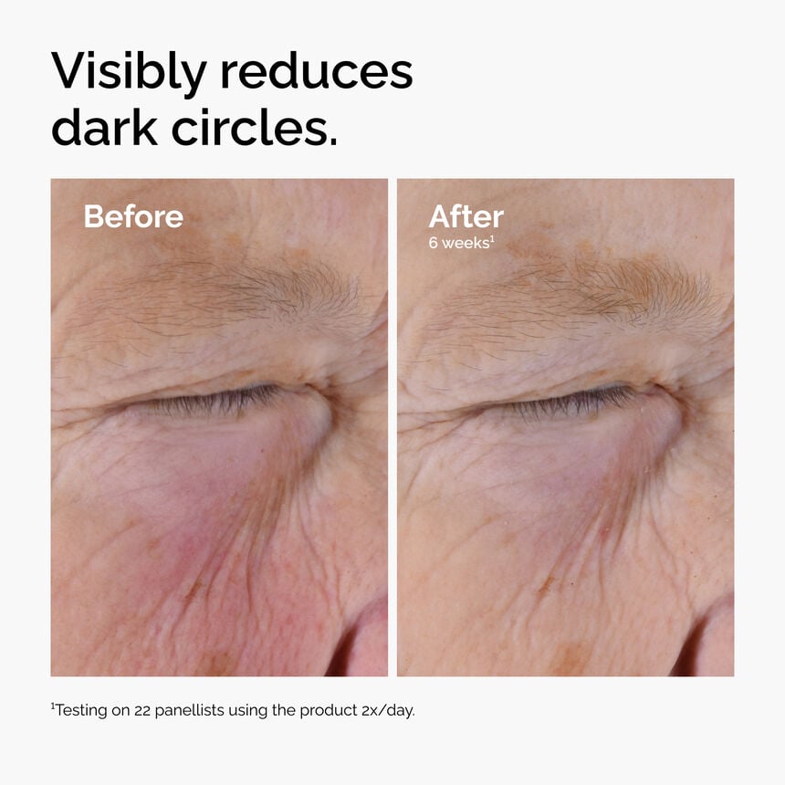 Caffeine?Solution 5% + EGCG Eye Serum - Image 3