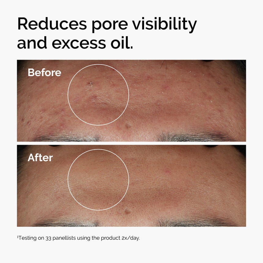 Niacinamide 10% + Zinc 1% - Image 4