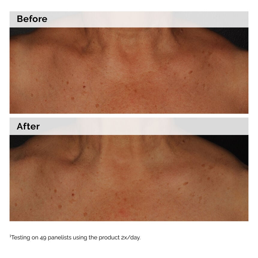 Niacinamide 5% Face and Body Emulsion - Image 3