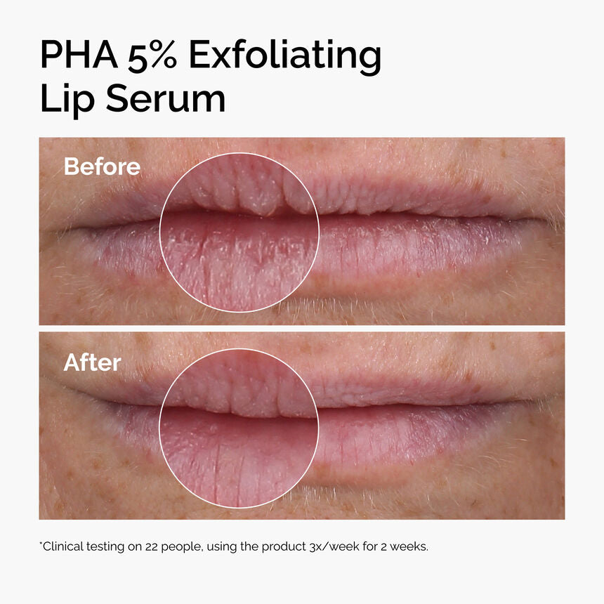 PHA 5% Exfoliating Lip Serum - Image 4
