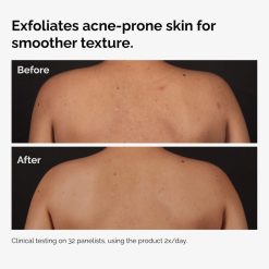 Alternative view of Salicylic Acid 0.5% Body Serum